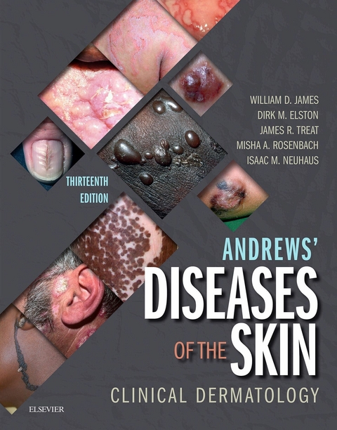 Andrews' Diseases of the Skin -  Dirk M. Elston,  William D. James,  Misha A. Rosenbach,  James R. Treat