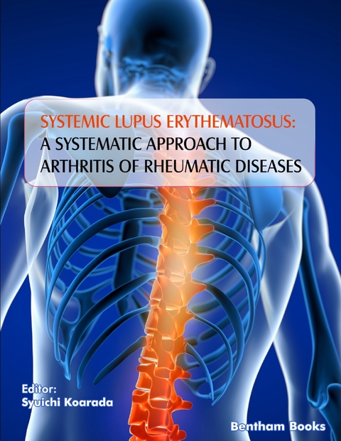 Systemic Lupus Erythematosus: A Systematic Approach to Arthritis of Rheumatic Diseases: Volume 4 - 