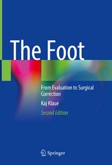 The Foot - Kaj Klaue