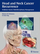 Head and Neck Cancer Recurrence - Hisham M. Mehanna, K. Kian Ang