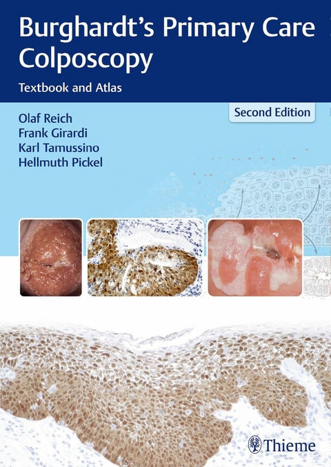 Burghardt's Primary Care Colposcopy - Olaf Reich, Frank Girardi, Karl Tamussino, Hellmuth Pickel