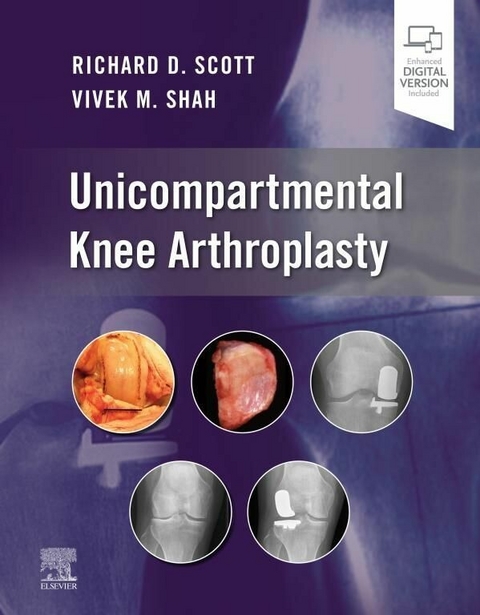 Unicompartmental Knee Arthroplasty, E-Book -  Richard D. Scott,  Vivek Shah