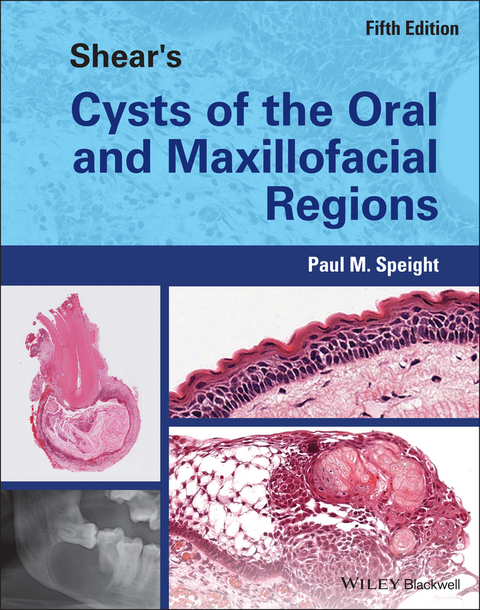 Shear's Cysts of the Oral and Maxillofacial Regions - Paul M. Speight