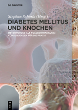 Diabetes Mellitus und Knochen - 