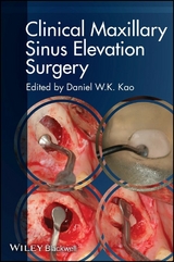 Clinical Maxillary Sinus Elevation Surgery - 