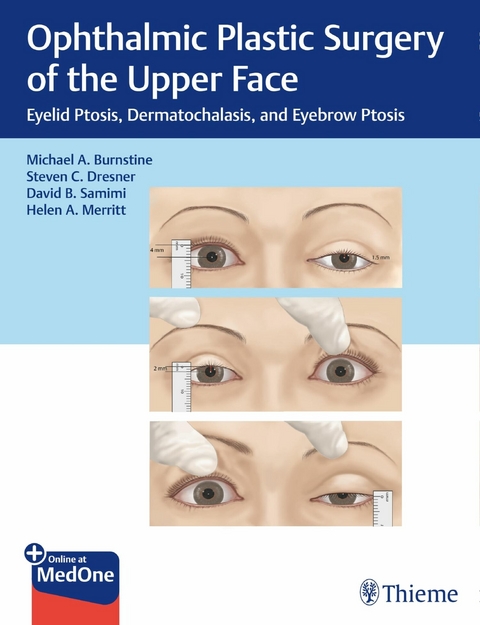 Ophthalmic Plastic Surgery of the Upper Face -  Michael A. Burnstine,  Steven C. Dresner,  Helen A. Merritt,  David B. Samimi