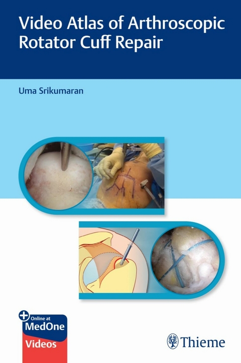 Video Atlas of Arthroscopic Rotator Cuff Repair -  Uma Srikumaran