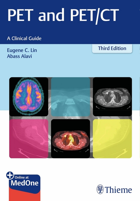 PET and PET/CT -  Eugene C. Lin,  Abass Alavi