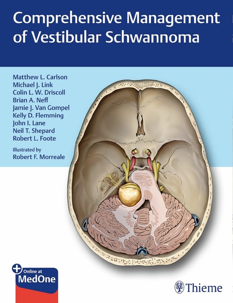 Comprehensive Management of Vestibular Schwannoma - 