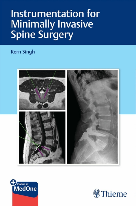 Instrumentation for Minimally Invasive Spine Surgery -  Kern Singh