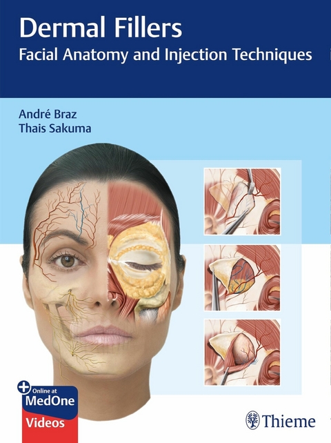 Dermal Fillers - André Vieira Braz, Thais Harumi Sakuma