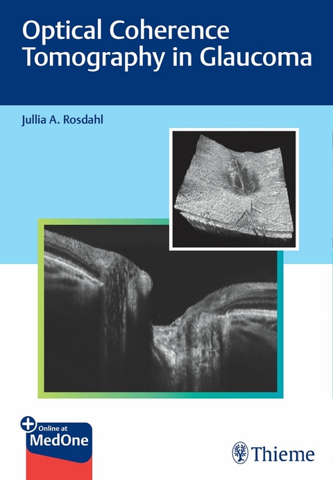 Optical Coherence Tomography in Glaucoma -  Jullia Rosdahl