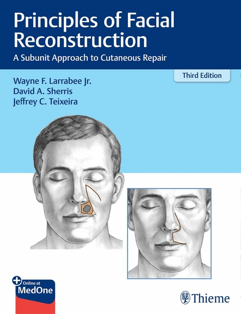 Principles of Facial Reconstruction -  Wayne F. Larrabee,  David A. Sherris,  Jeffrey Teixeira