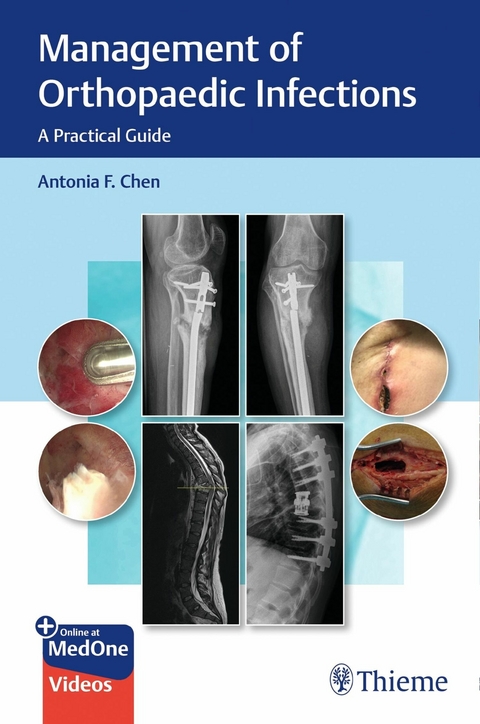 Management of Orthopaedic Infections -  Antonia Chen