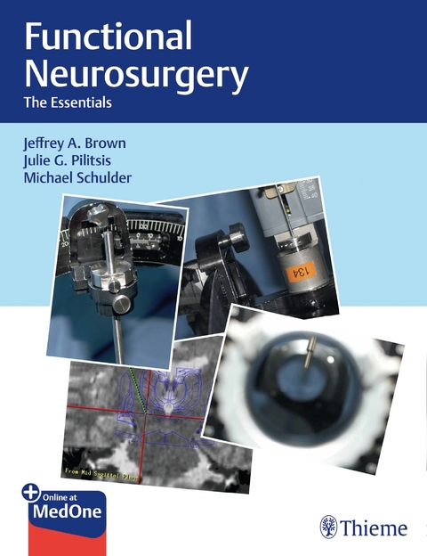 Functional Neurosurgery -  Jeffrey A. Brown,  Julie G. Pilitsis,  Michael Schulder