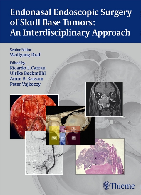 Endonasal Endoscopic Surgery of Skull Base Tumors: An Interdisciplinary Approach - Wolfgang Draf, Ricardo L. Carrau, Ulrike Bockmühl, Amin B. Kassam, Peter Vajkoczy