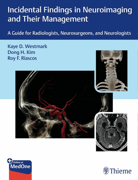 Incidental Findings in Neuroimaging and Their Management -  Kaye D. Westmark,  Dong H. Kim,  Roy F. Riascos-Castaneda