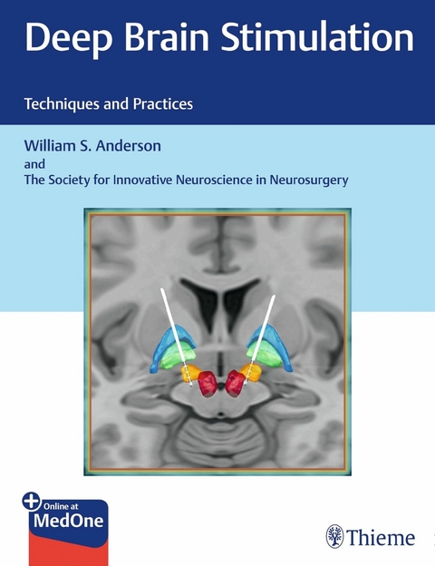 Deep Brain Stimulation -  William S. Anderson,  The Society for Innovative Neuroscience