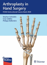 Arthroplasty in Hand Surgery - 