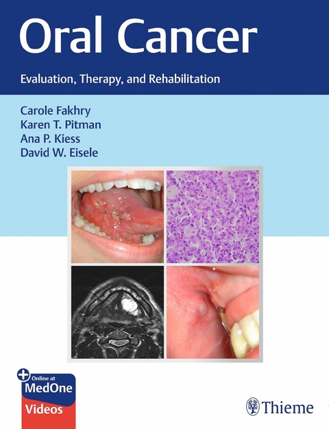 Oral Cancer -  Carole Fakhry,  Karen T. Pitman,  Ana P. Kiess,  David W. Eisele