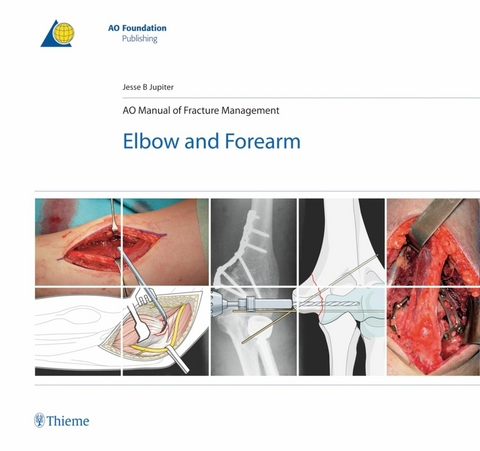 AO Manual of Fracture Management - Elbow and Forearm -  Jesse Jupiter