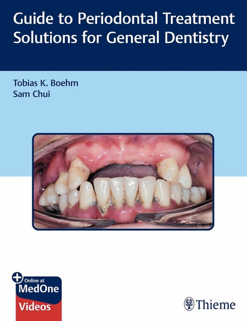 Guide to Periodontal Treatment Solutions for General Dentistry -  Tobias K. Boehm,  Sam Chui