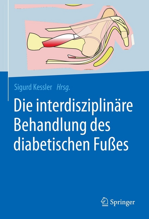 Die interdisziplinäre Behandlung des diabetischen Fußes - 