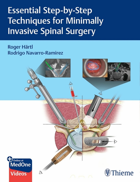 Essential Step-by-Step Techniques for Minimally Invasive Spinal Surgery -  Roger Hartl,  Rodrigo Navarro-Ramirez