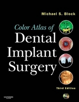 Color Atlas of Dental Implant Surgery - Block, Michael S.