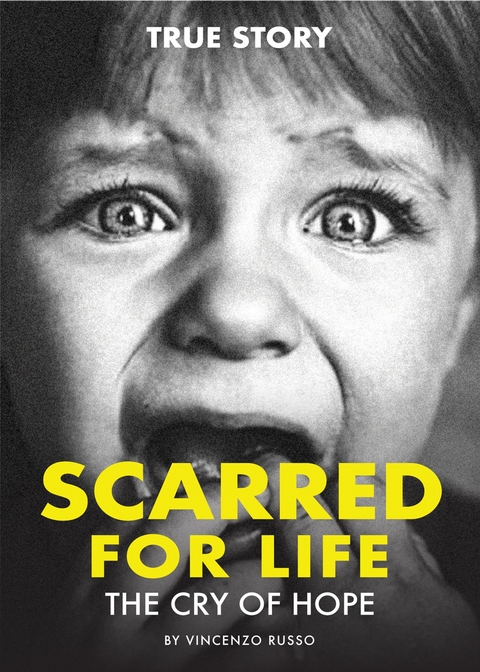 SCARRED FOR LIFE -  Vincenzo Russo