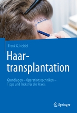 Haartransplantation - Frank G. Neidel