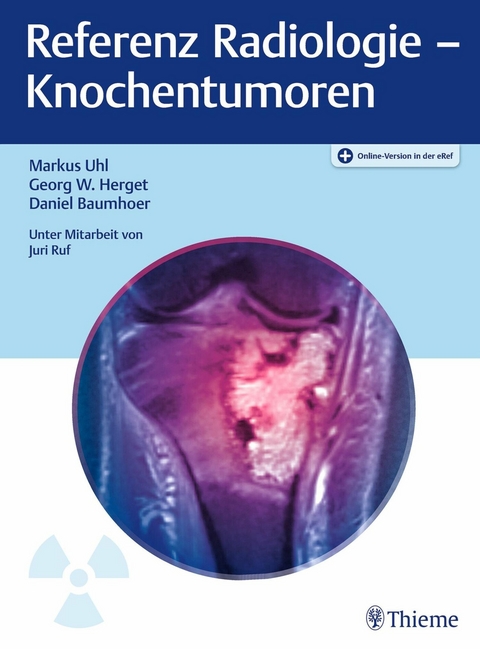 Referenz Radiologie - Knochentumoren -  Markus Uhl,  Georg W. Herget,  Daniel Baumhoer