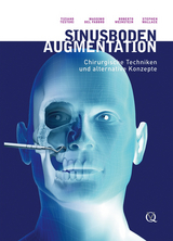 Sinusbodenaugmentation - Tiziano Testori, Massimo del Fabbro, Roberto Weinstein, Stephen Wallace