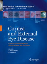 Cornea and External Eye Disease - 