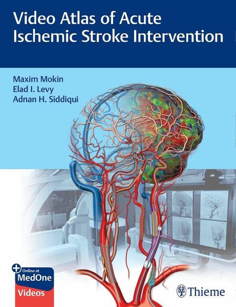 Video Atlas of Acute Ischemic Stroke Intervention -  Maxim Mokin,  Elad Levy,  Adnan Siddiqui