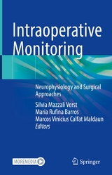 Intraoperative Monitoring - 