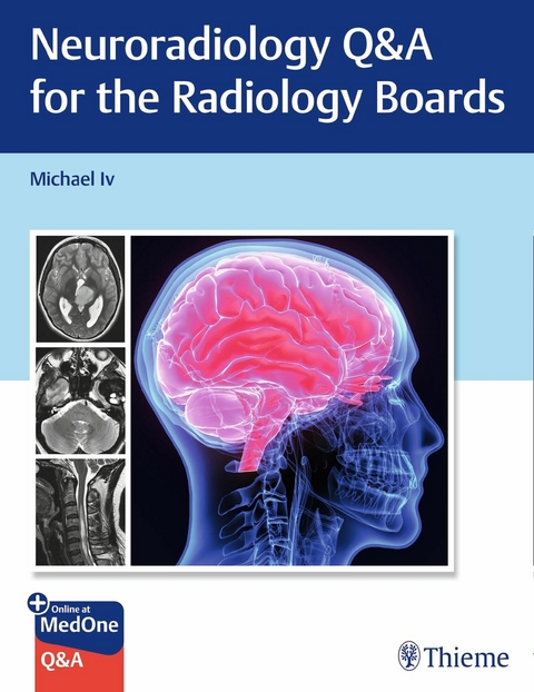 Neuroradiology Q&A for the Radiology Boards -  Michael Iv