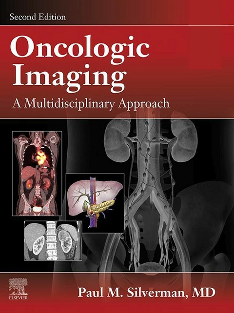 Oncologic Imaging: A Multidisciplinary Approach E-Book -  Paul M. Silverman