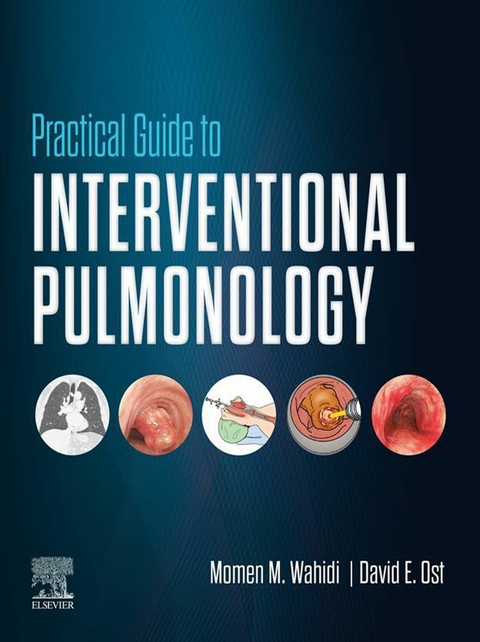 Practical Guide to Interventional Pulmonology E-Book - 