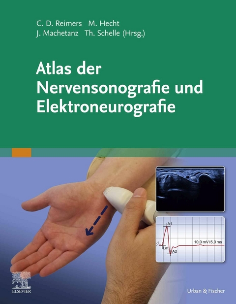 Atlas der Nervensonografie und Elektroneurografie - 