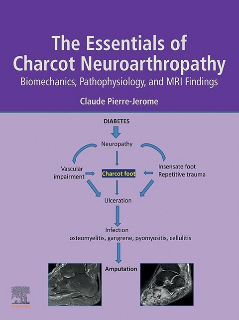 Essentials of Charcot Neuroarthropathy -  Claude Pierre-Jerome