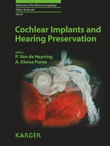 Cochlear Implants and Hearing Preservation - 