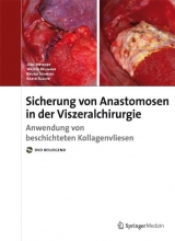 Sicherung von Anastomosen in der Viszeralchirurgie - Jürg Metzger, Walter Brunner, Bruno Schmied, Karin Bläuer