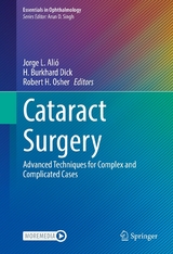 Cataract Surgery - 