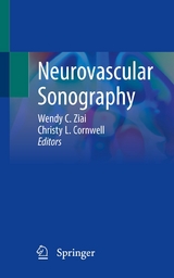 Neurovascular Sonography - 