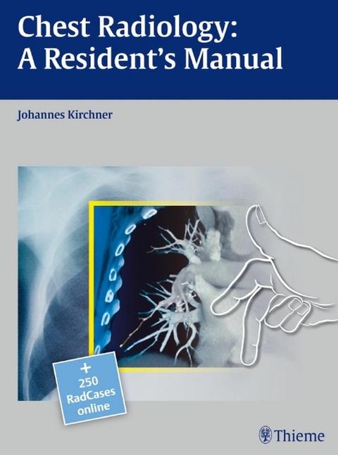 Chest Radiology: A Resident's Manual -  Johannes Kirchner