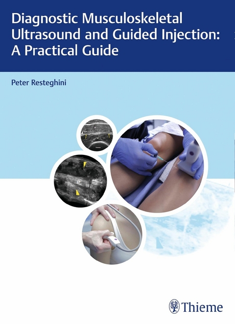 Diagnostic Musculoskeletal Ultrasound and Guided Injection: A Practical Guide -  Peter Resteghini