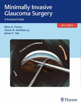 Minimally Invasive Glaucoma Surgery -  Brian Francis,  Steven Sarkisian,  James C. Tan