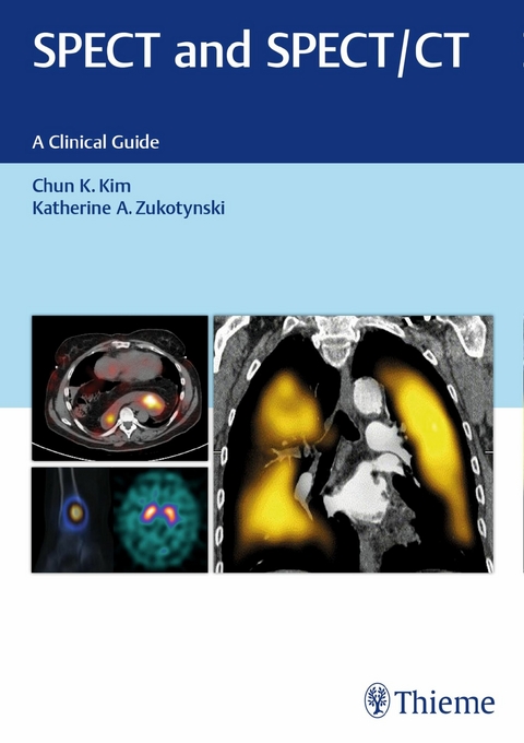 SPECT and SPECT/CT -  Chun Kim,  Katherine Zukotynski