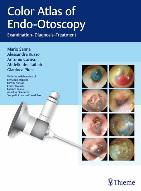 Color Atlas of Endo-Otoscopy -  Mario Sanna,  Alessandra Russo,  Antonio Caruso,  Abdelkader Taibah,  Gianluca Piras